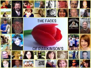 parkinson faces